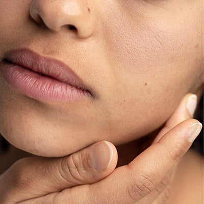 What Are Skin Types? A Complete Guide to Understanding Your Skin