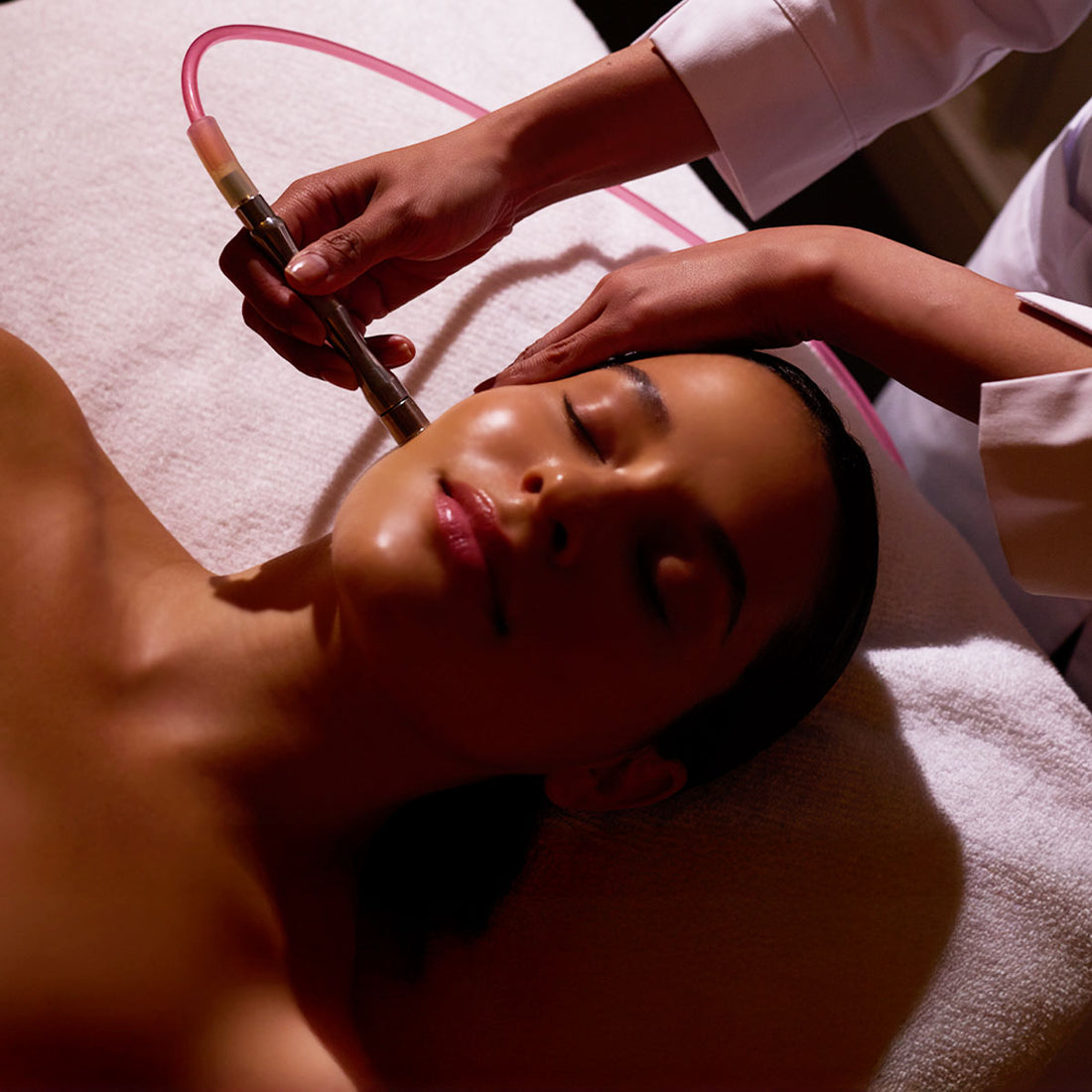 Microdermabrasion